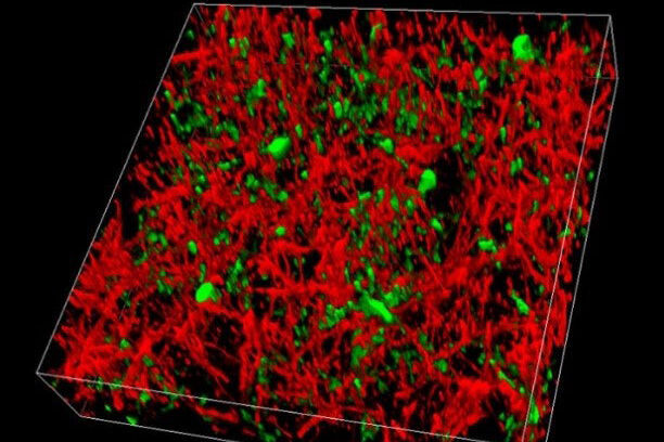 Effortless separation of GFP (green) and YFP (red) expressed in the cortex of a live mouse by capturing either two channels simultaneously or conducting a spectral emission scan and applying channel unmixing in the LAS X software.