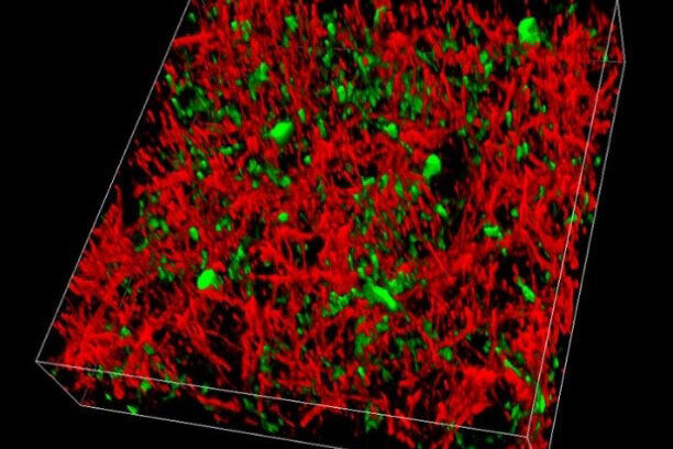 Effortless separation of GFP (green) and YFP (red) expressed in the cortex of a live mouse by capturing either two channels simultaneously or conducting a spectral emission scan and applying channel unmixing in the LAS X software.