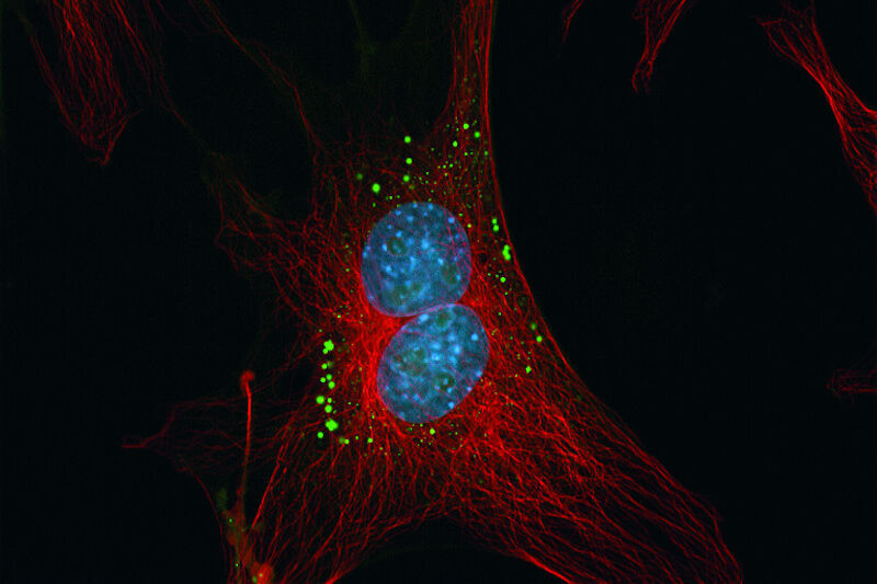 Bovine Pulmonary Endothelial cells