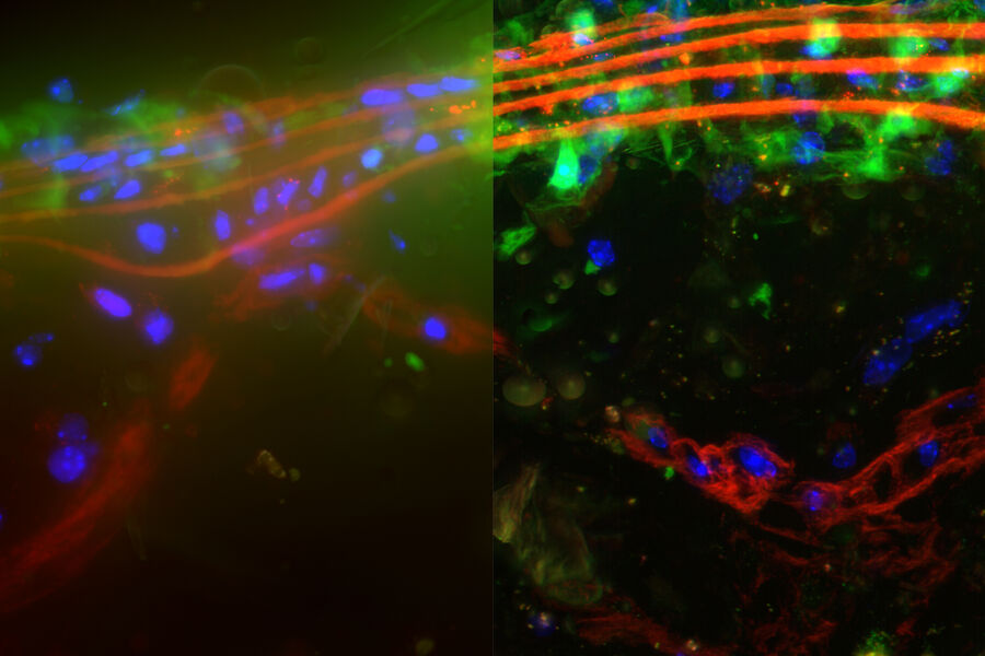 Mouse Aorta - THUNDER Imager 3D Tissue