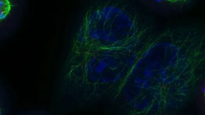 Human colorectal carcinoma cells. Maximum intensity projections of 8 prometaphase-metaphase mitotic spindles in HCT116 human colorectal carcinoma cells, captured using STELLARIS TauSTED microscopy. The kinetochore protein NDC80 is shown in red, alpha-Tubulin in green, and DNA in blue. Courtesy of  Danny Gold (Francis Barr lab), University of Oxford.