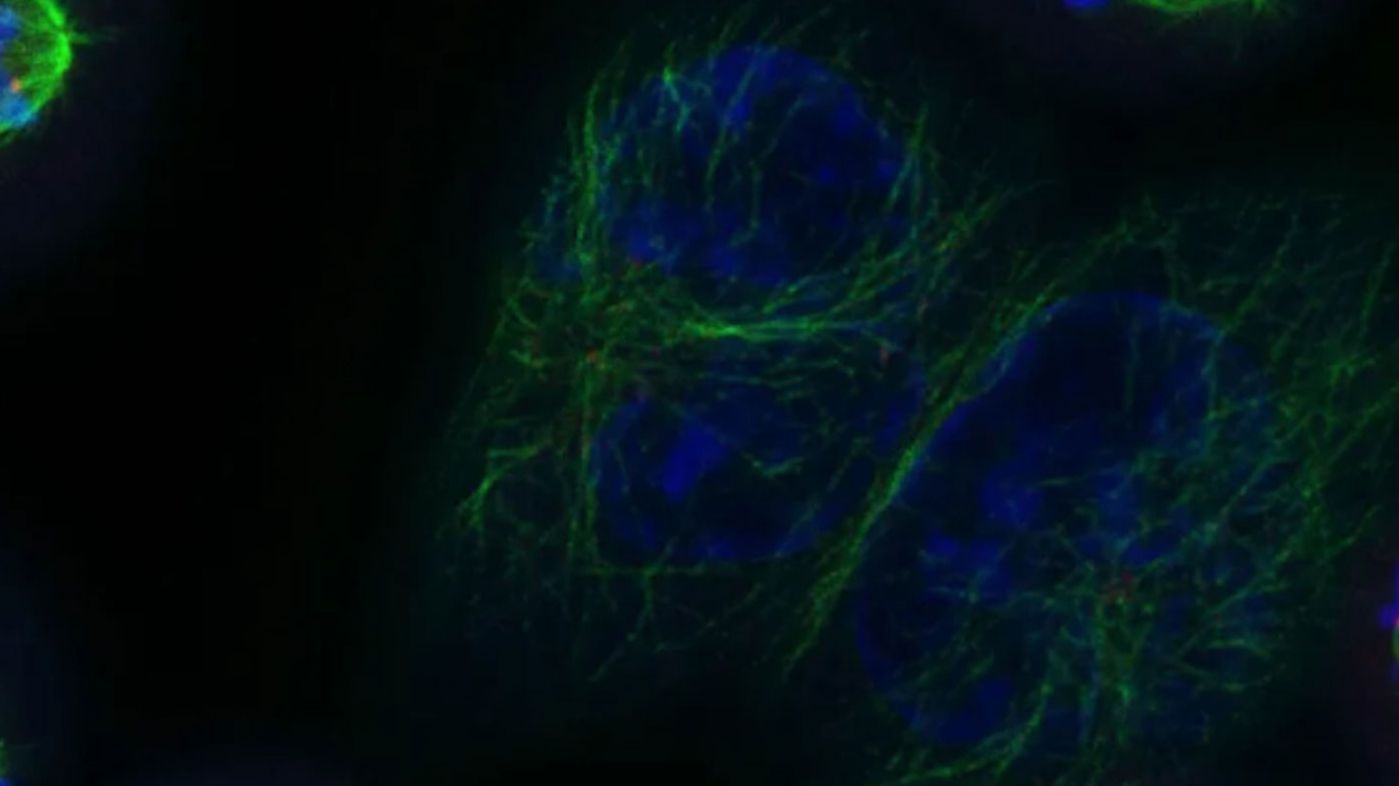 Human colorectal carcinoma cells. Maximum intensity projections of 8 prometaphase-metaphase mitotic spindles in HCT116 human colorectal carcinoma cells, captured using STELLARIS TauSTED microscopy. The kinetochore protein NDC80 is shown in red, alpha-Tubulin in green, and DNA in blue. Courtesy of  Danny Gold (Francis Barr lab), University of Oxford.