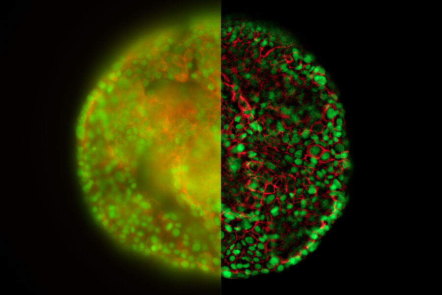 HeLa cell spheroid - THUNDER Imager 3D Live Cell & 3D Cell Culture