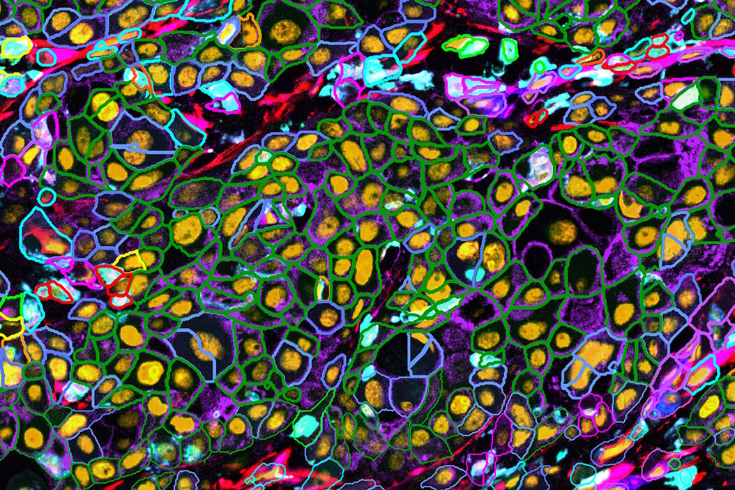 Die Zellzahlen für jeden Biomarker wurden durch die Gesamtzahl der Zellen geteilt, um den prozentualen Anteil der Biomarker-positiven Zellen an den Gesamtzellen für jeden Biomarker zu ermitteln. Cell_counts_for_biomarkers_with_Cell_DIVE.jpg