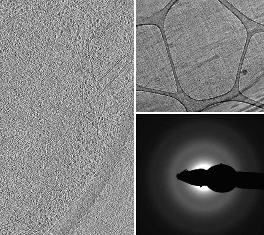 Left = Optical slice from a tomographic reconstruction. Top right = Micrograph of a vitrified yeast cell. Bottom right = Diffraction pattern image.