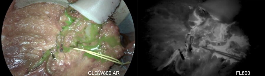 Inspecting blood flow_ICG fluorescence camera GLOW 800 & florescence-aided angiography FL800