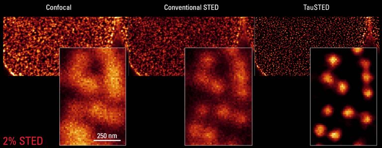 STED para biologia celular: O TauSTED 660 revela a distribuição de poros nucleares (NPCs) em células COS7 imunomarcadas para complexos Nup com AF555. Apenas 2% da luz STED revela muito mais detalhes. O anticorpo primário mAb414 reconhece várias nucleoporinas do complexo de poros e produz uma coloração semelhante tipo pontilhada.