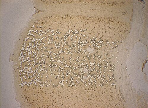 Murine brain cryosection after laser microdissection. DAB staining Murine brain cryosection after laser microdissection. DAB staining
