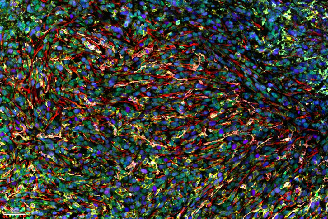 Cell DIVE multiplexed image of FFPE tissue section from syngeneic murine cancer model, 4T1. FFPE_tissue_section_from_syngeneic_murine_cancer_model.jpg