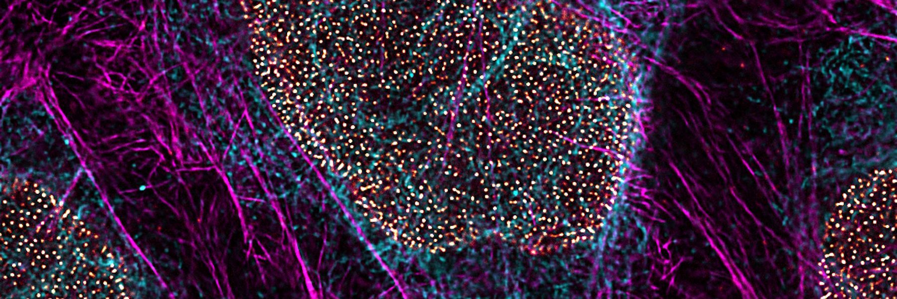 Multicolor TauSTED Xtend 775 for Cell Biology applications that require nanoscopy resolution for multiple cellular components. Cells showing vimentin fibrils (AF 594), actin network (ATTO 647N), and nuclear pore basket (CF 680R). Sample courtesy of Brigitte Bergner, Mariano Gonzales Pisfil, Steffen Dietzel, Core Facility Bioimaging, Biomedical Center, Ludwig-Maximilians-University, Munich, Germany.