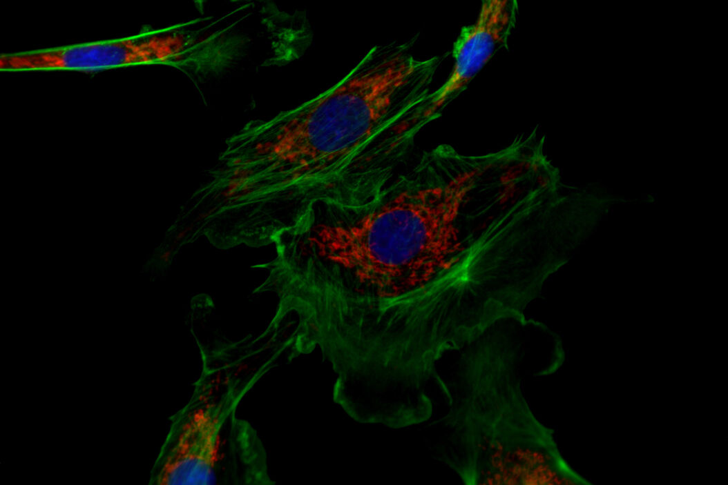 Image of immunofluorescently labelled cells where mitochondria are indicated with red, nuclei with blue, and actin with green. Upright_Fluorescence_Microscopy_for_Virus_Replication_Studies_SemrockSlide.jpg
