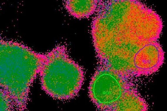 Snapshot from a time lapse of a calcium imaging experiment using the ratiometric calcium indicator Fura-2. Time_lapse_of_calcium_imaging_experiment_using_the_ratiometric_calcium_indicator_Fura-2.jpg