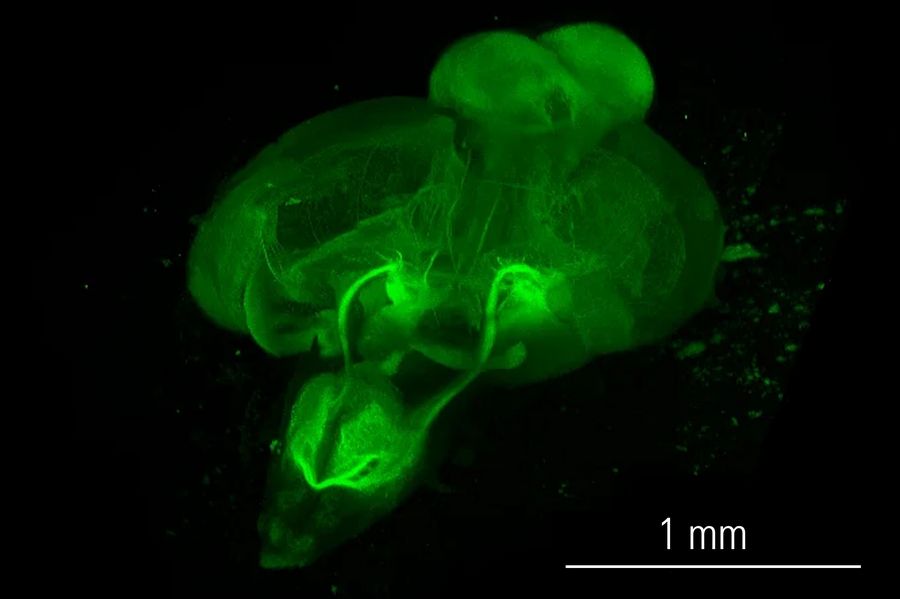 A whole brain stained with enhanced green fluorescent protein which was dissected from a developing zebrafish.
