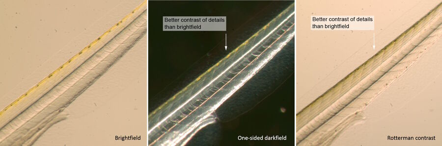 Fig. 11: Tail of zebrafish larva imaged with a MZ series fluorescence stereo microscope using a 1x Plan Apo objective lens and a TL base at 11.5x total magnification. Notice the better contrast of details from darkfield and Rottermann contrast imaging versus brightfield.