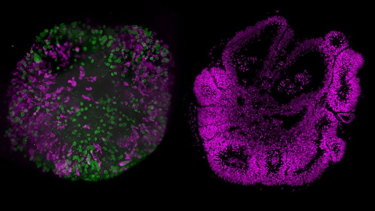 Left: 40-h time-lapse of a human brain organoid. Courtesy of Akank¬sha Jain, Treutlein Lab ETH-DBSSE Basel, CH. Right: Z-stack image of a cleared 60-day-old human brain organoid. Courtesy of Professor Barbara Treutlein, ETH, D-BSSE Basel, Switzerland. 