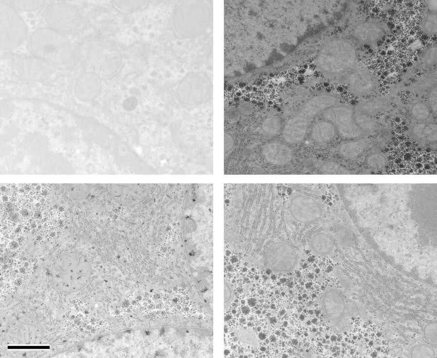 Comparison of mouse liver sections after automatic staining with UA, OTE, and Pt Blue