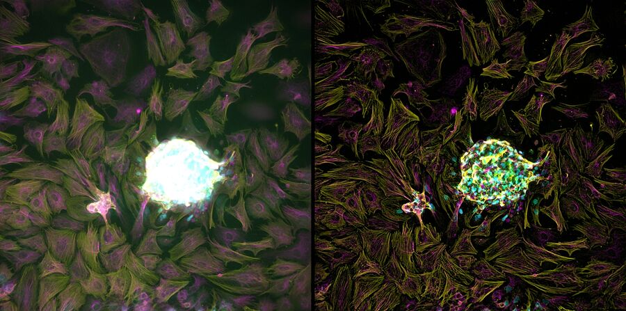 Developing Heart Pacemaker Cells from Cardiac Spheroids Developing Heart Pacemaker Cells from Cardiac Spheroids. Cardiac Spheroid shown here as a maximum projection of the raw widefield image data (left) and THUNDER image after Instant Computational Clearing (right). The images are derived from approximately 60 µm Z stacks. Different stains (alpha actin and vimentin) are used to help identify the various cell types. Images courtesy of Sandra Grijalva, Wallace H. Coulter Department of Biomedical Engineering, Georgia Tech and Emory University, Atlanta, USA.