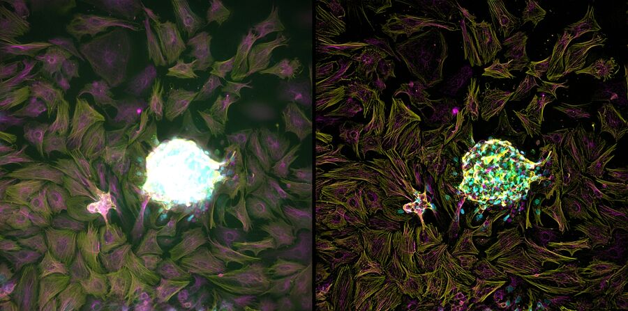 Developing Heart Pacemaker Cells from Cardiac Spheroids. Cardiac Spheroid shown here as a maximum projection of the raw widefield image data (left) and THUNDER image after Instant Computational Clearing (right). The images are derived from approximately 60 µm Z stacks. Different stains (alpha actin and vimentin) are used to help identify the various cell types. Images courtesy of Sandra Grijalva, Wallace H. Coulter Department of Biomedical Engineering, Georgia Tech and Emory University, Atlanta, USA.