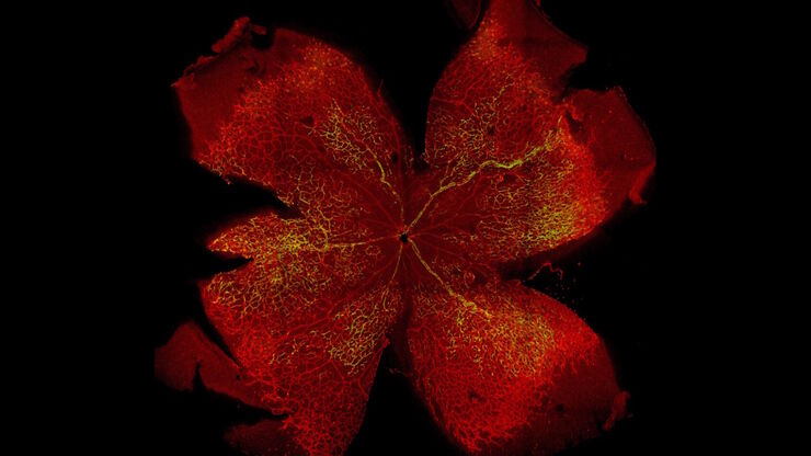 Cdc42 knock-out retina stained with isolectin B4 (red) and a YFP reporter for Cre-mediated recombination in endothelial cells (green).