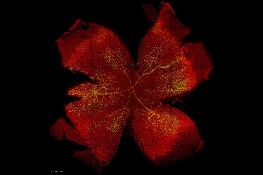 Cdc42 knock-out retina stained with isolectin B4 (red) and a YFP reporter for Cre-mediated recombination in endothelial cells (green). Cdc42 knock-out retina stained with isolectin B4 (red) and a YFP reporter for Cre-mediated recombination in endothelial cells (green).
