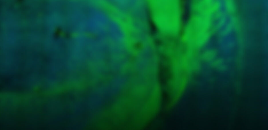 STELLARIS CRS Microscopio Coherent Raman Scattering | Productos | Leica ...