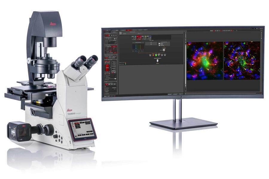 THUNDER Imager 3D Cell Culture basiert auf einem vollständig motorisierten DMi8-Mikroskop, einem Quantum-Tisch, einer hochempfindlichen DFC9000 GTC-Kamera und einer mehrzeiligen Fluoreszenz-LED-Lichtquelle mit hoher Lichtstärke. Diese Lösung ist für das schnelle und präzise Mehrpositions- und Mehrkanal-Imaging von 3D-Zellkulturen optimiert. 