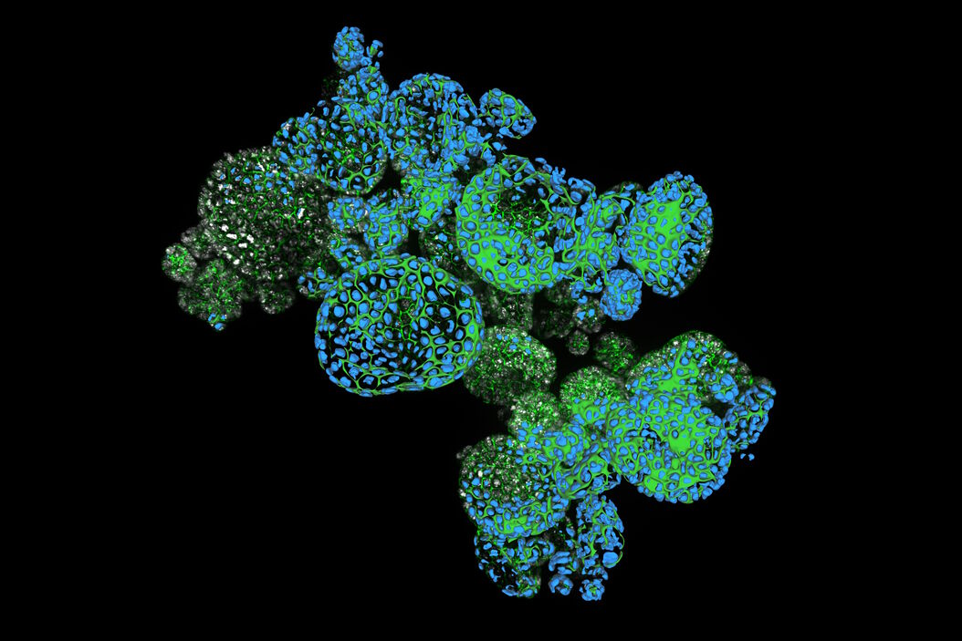 Dapi – Nucleus, GFP – Plasma Membrane, Thickness 100µm, 63x objektive, 469 Z planes, 2 channels, THUNDER Imager 3D Cell Culture. Courtesy M.Sc. Dana Krauß, Medical University of Vienna (Austria). Two_color_organoid_cluster.jpg