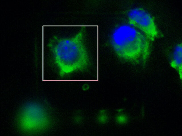 Immagine a fluorescenza di una cellula visualizzata su una griglia EM e contrassegnata in modo selettivo con EM Cryo CLEM. Immagine a fluorescenza di una cellula visualizzata su una griglia EM e contrassegnata in modo selettivo con EM Cryo CLEM.