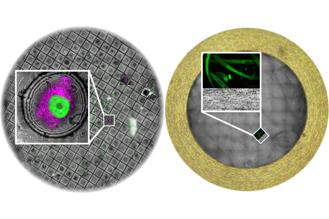 Trichomonas parasite in mouse gut, rOTO Embedding and serial sections for array tomography imaging. Sample courtesy Isabelle Guerin-Bonne, Low Kay En, Electron Microscopy Unit, Yong loo Lin School of Medicine, National University of Singapore Trichomonas_parasite_in_mouse_gut.jpg