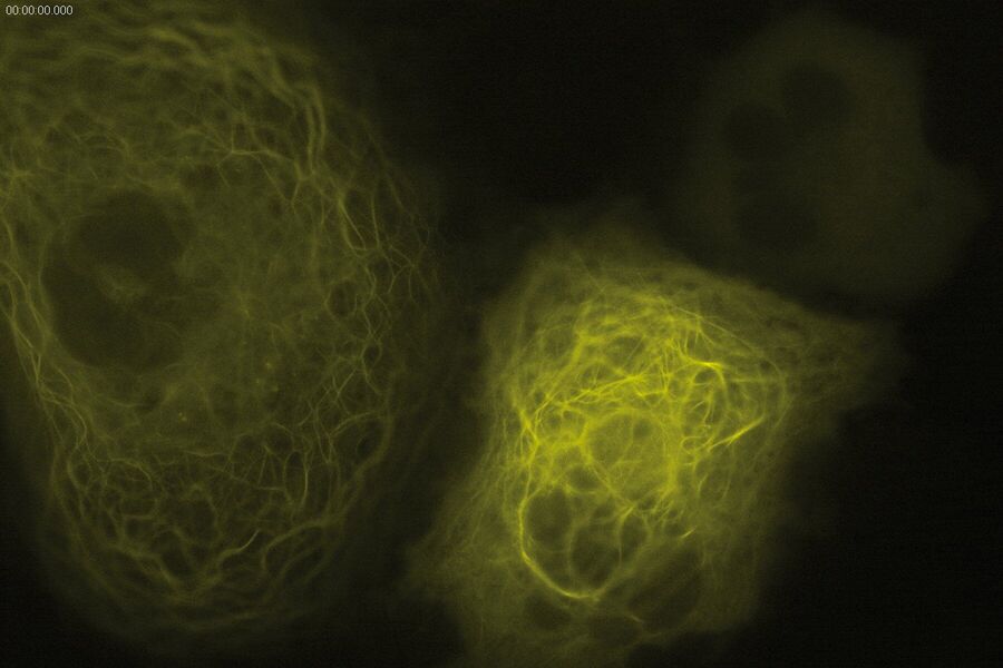 Widefield image of Tubulin expressing YFP