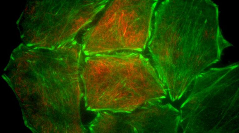 Hela cells stably expressing Actin Chromobody-Tag GFP2 and stained with SIR-Tubulin. Courtesy of ChromoTek GmbH, Munich, Germany, and Spirochrome SA.