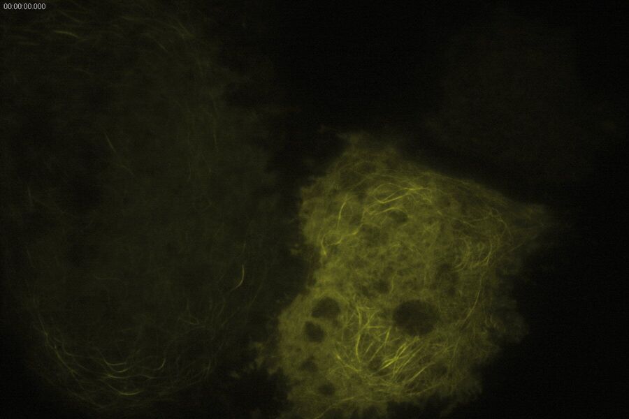 TIRF Image of Tubulin, YFP, penetration depth: 90 mm