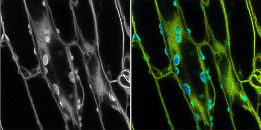 Fluorescence microscopy image on the left with no distinction between the fluorescent signal and background autofluorescence. TauSense modes were used in the image on the right to differentiate autofluorescence in chloroplasts (blue) from the desired fluorescent signal from the cell membrane (green). Sample Courtesy of Prof. Dr. Karin Schumacher, COS, Zellbiologie, Ruprecht-Karls-Universität Heidelberg.