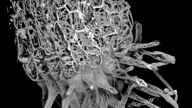 Traditional Confocal Traditional Confocal