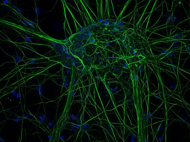 Adquirida com THUNDER Imager 3D Cell Culture