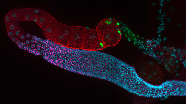Microscopía de fluorescencia