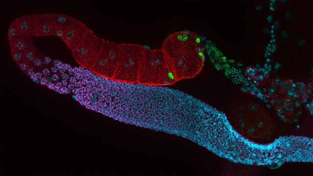 Microscopia de fluorescência