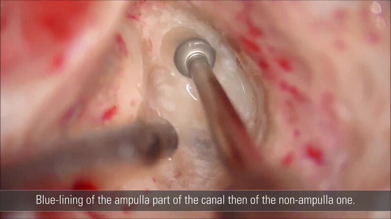 新耳鼻咽喉科学 = MODERN OTO-RHINO-LARYNGOLOGY 新耳鼻咽喉科学 = MODERN OTO-RHINO-LARYNGOLOGY Laryngology