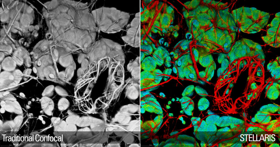 Arabidopsis Thaliana leaf with stomatum. 