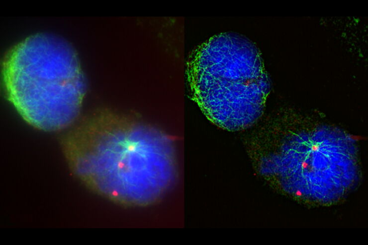 Raw widefield (left) and THUNDER (right) image of Ewing Sarcoma cells (SK-ES-1).