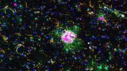 Multiplexed Cell DIVE imaging of Adult Human Alzheimer’s Brain Tissue labelled with 15 antibodies targeted towards markers specific to astrocytes (GFAP, S100B), microglia (TMEM119, IBA1), and Alzheimer’s-associated markers (β-amyloid and p-Tau217).