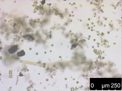 Pond water with algae and diatoms captured with transmitted light.