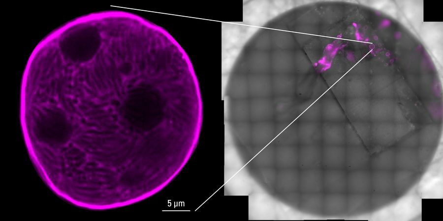 Cryo-confocal fluorescence imaging of the cryo-planed sample reveals spherical oocysts within mosquito midgut tissue. These structures contain developing malaria parasites and define regions of interest for targeted lamella preparation in the correlative cryo-electron tomography workflow. Sample courtesy: Nedal Darif, Postdoctoral Fellow, EMBL Heidelberg, Germany; Image acquisition: Martin Fritsch, ALMF, EMBL Heidelberg, Germany