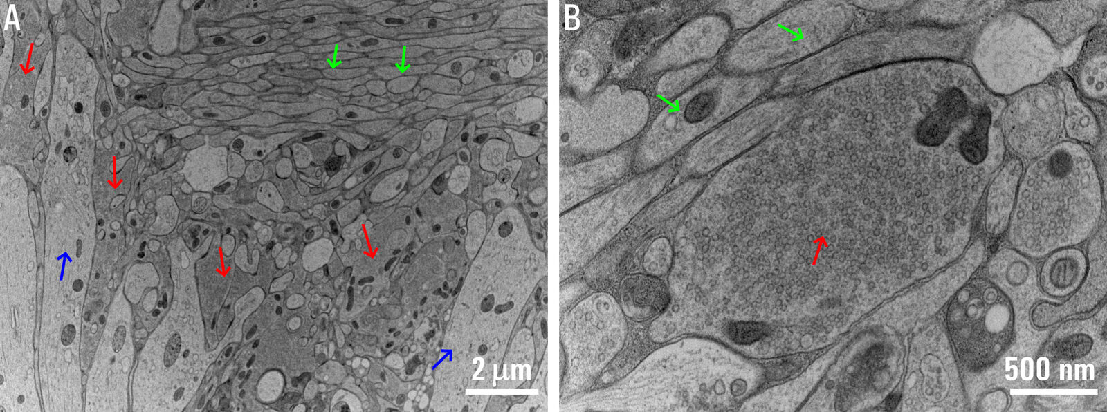 A high magnification image of synapse obtained by electron microscopy