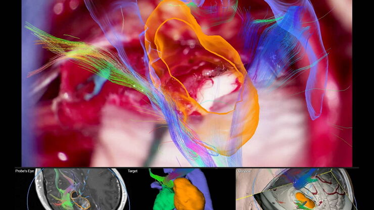 Image Guided Surgery Image Guided Surgery