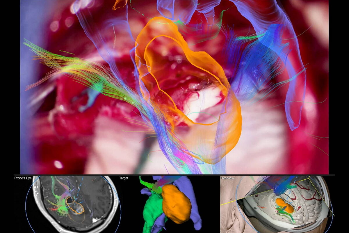 Navigating Through the Brain | Learn & Share | Leica Microsystems