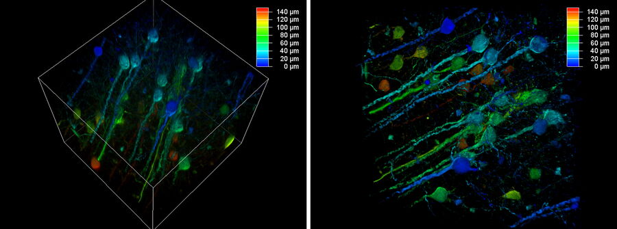 Volume rendering of a computationally cleared 150 μm brain section.