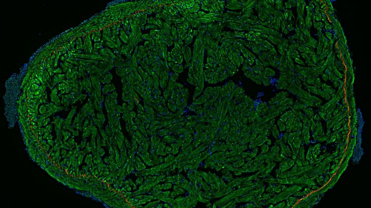 Zebrafish heart, DAPI (nuclei, blue), Tropomyosin (cardiomyocytes, red) and GFP (primordial cardiac layer, green). Courtesy of Anna Jazwinska, University of Fribourg, Switzerland.