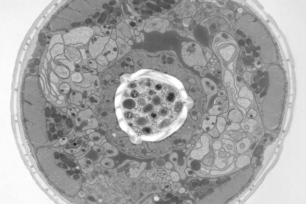 Electron microscope (EM) image of a cross section of C. elegans (roundworm). Courtesy of T. Müller-Reichert, MPI-CBG, Dresden, Germany and K. McDonald, University of California, Berkeley, USA. EM_image_of_cross_section_C_elegans.jpg