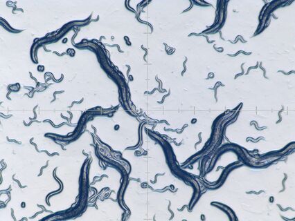 Image of the worm C. elegans captured with a transmitted light base; fast and easy measurements due to continuously encoded zoom
